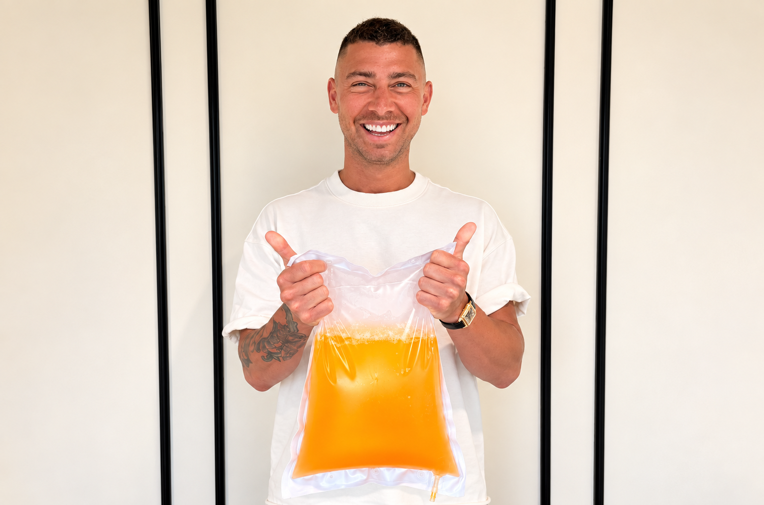Smiling patient giving two thumbs up while holding a bag of filtered yellow plasma during a DFPP session at LINNA Clinic Bangkok